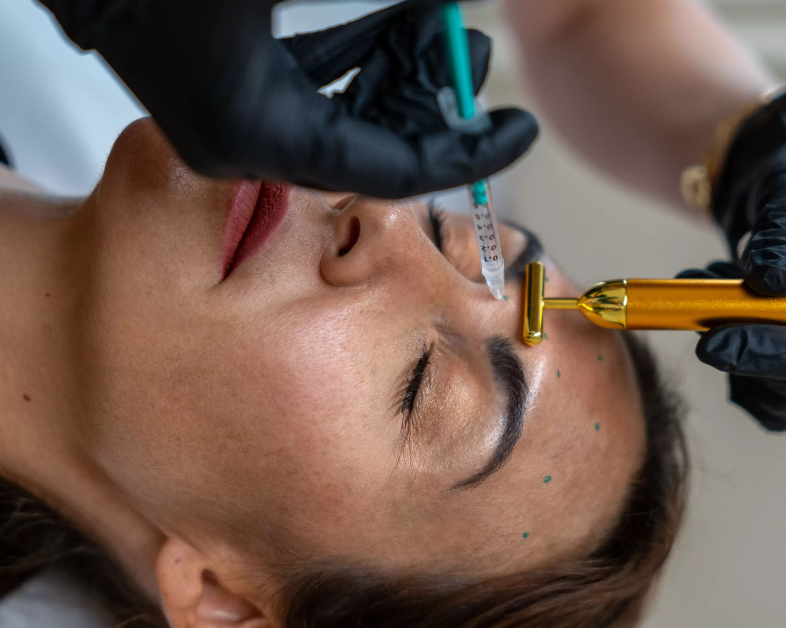 Botox-Behandlung gegen Falten bei Dr. Rosalia Luketina in Zürich